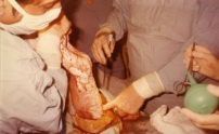 Image-11.jpg: 1979/07/23 - Lisa's Birth - 1979